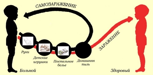 Высыпание на коже у ребенка, красные пятна, крапивница, прыщики с зудом. Причины и лечение в домашних условиях