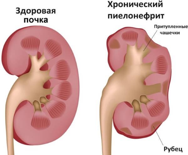 Амоксициллин. Инструкция по применению: таблетки, суспензия, капсулы взрослым и для детей