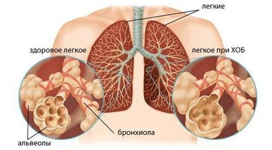 Амоксициллин. Инструкция по применению: таблетки, суспензия, капсулы взрослым и для детей