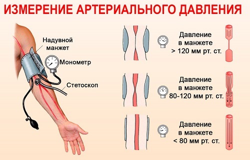 Какой лучше купить аппарат для измерения давления: автомат, полуавтомат, механический. АНД, Омрон, производители России, Швейцарии, Германии, Японии