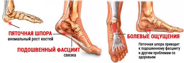 Боль в ногах от колена до стопы спереди, сзади, ноющая, тянущая, резкая. Причины и лечение