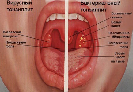 Настойка Эхинацеи. Инструкция по применению для детей и взрослых. Аналоги, цена, отзывы