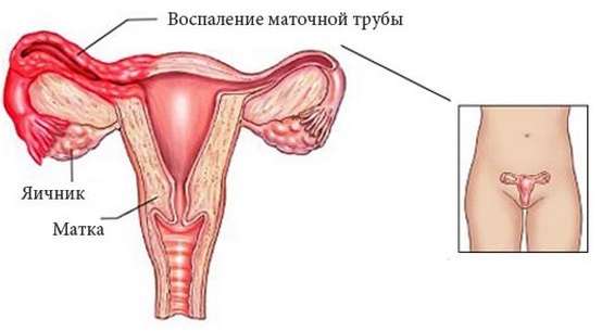 Настойка Эхинацеи. Инструкция по применению для детей и взрослых. Аналоги, цена, отзывы