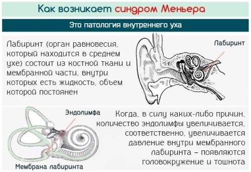 Головокружение: причины у женщин при нормальном давлении, смене положения, климаксе, в иных случаях. Способы лечения