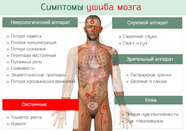 Головокружение: причины у женщин при нормальном давлении, смене положения, климаксе, в иных случаях. Способы лечения