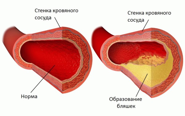 Почему мерзнут пальцы на ногах, руках, немеют. Причины и лечение, что это означает. Болезни системы кровообращения