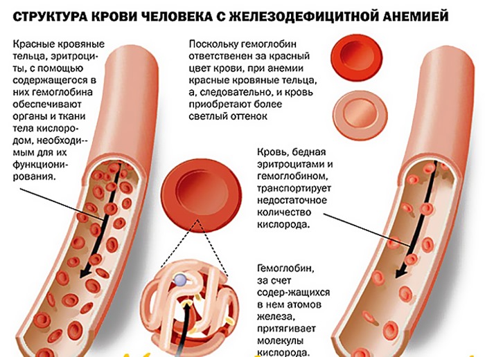 Почему мерзнут пальцы на ногах, руках, немеют. Причины и лечение, что это означает. Болезни системы кровообращения