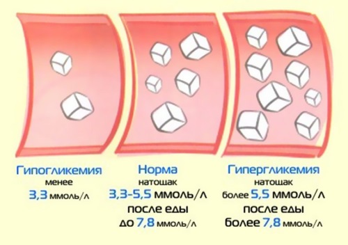 Норма сахара в крови у мужчин, женщин по возрасту. Таблица, расшифровка анализа из пальца, вены натощак, при замере глюкометром, через 1 час после еды