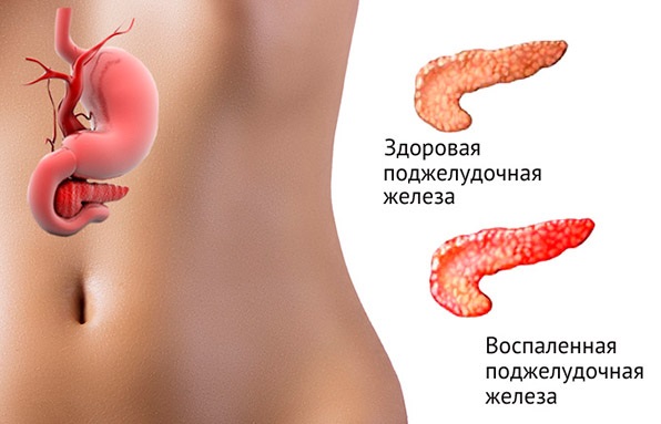 Омепразол. Инструкция по применению, цена, отзывы, аналоги