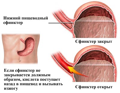 Омепразол. Инструкция по применению, цена, отзывы, аналоги