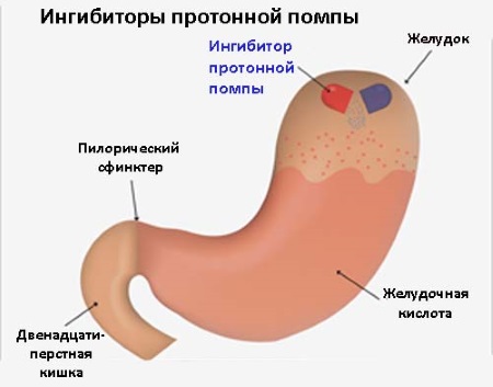 Омепразол. Инструкция по применению, цена, отзывы, аналоги