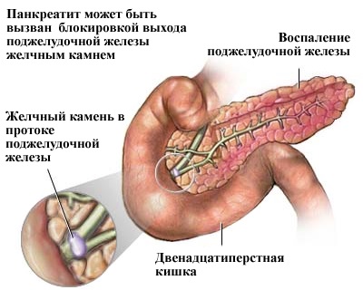 Панкреатин. Инструкция по применению, состав, свойства. От чего помогает взрослым и детям