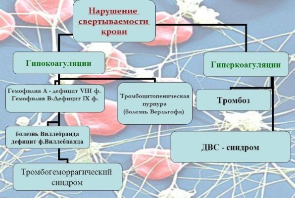 Синдром гиперстимуляции яичников презентация