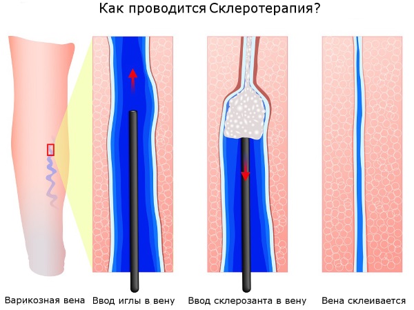 Тонкая кожа и выступающие вены: причины у парней, девушек. Почему видны, вздуваются. Уход за тонкой кожей  лица и тела