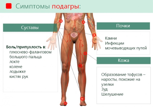 Боль в колене сбоку с внутренней стороны, внешней, наружной, от и до бедра. Причины и лечение. К какому врачу обратиться