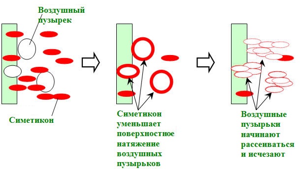 Газы в кишечнике – причины, как избавиться. Лечение метеоризма: таблетки, народные средства в домашних условиях