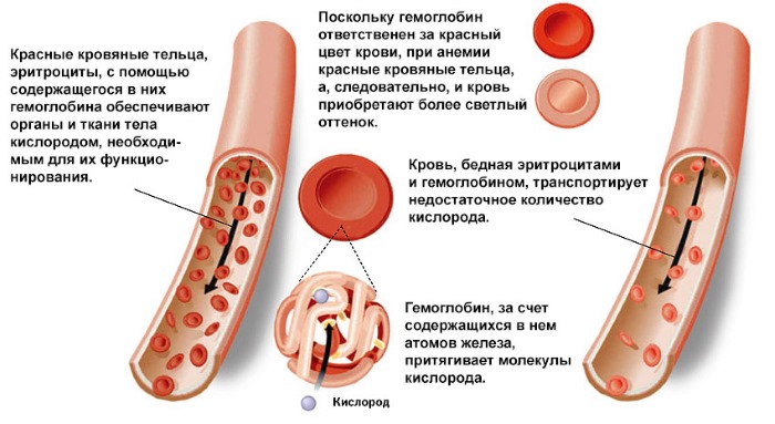 Гестоз при беременности - что это такое, признаки, симптомы, последствия и лечение