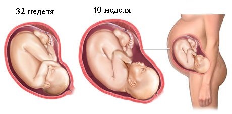 Ибупрофен. Инструкция по применению. От чего помогает. Аналоги, цена, отзывы