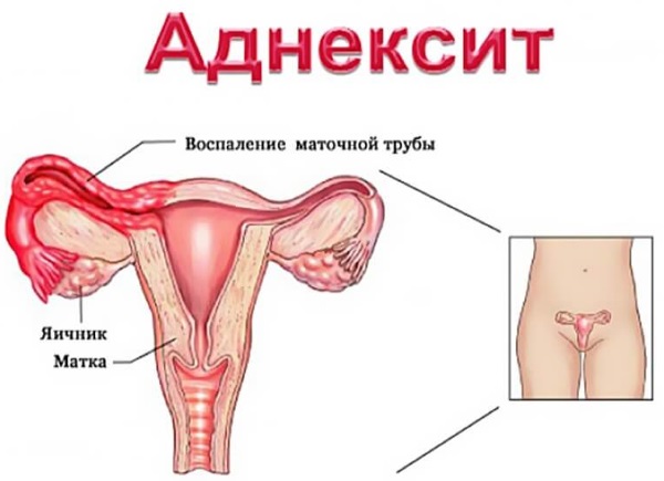 Ибупрофен. Инструкция по применению. От чего помогает. Аналоги, цена, отзывы