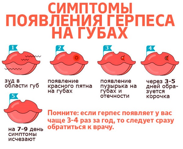 Лучшие мази от герпеса на губах. Список и цены: Оксолиновая, Ацикловир, Тетрациклиновая, Цинковая, Тридерм