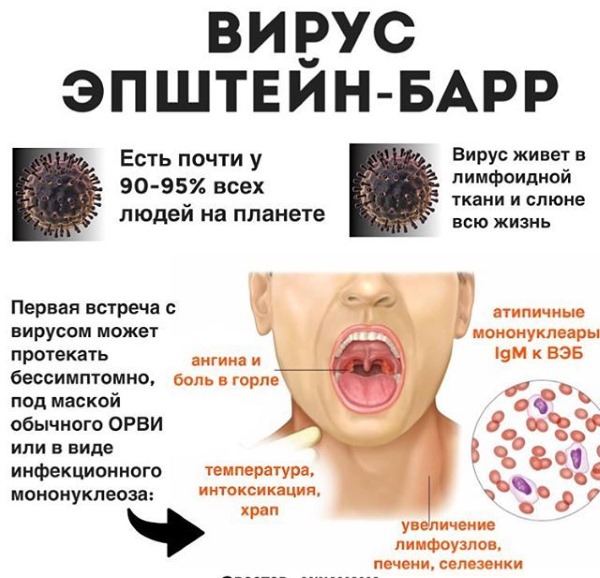 Монокулезная инфекция. Что это такое у детей, взрослых. Фото симптомов, лечение, клинические рекомендации