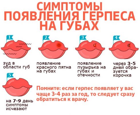 Верхняя губа больше нижней у женщин фото