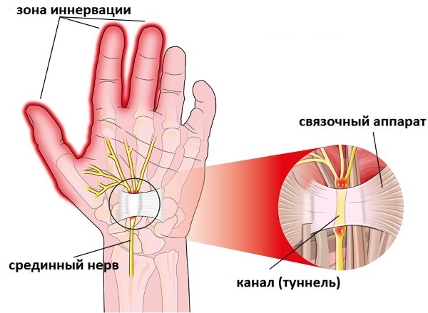 Болезнь пальцев рук мизинца и безымянного thumbnail