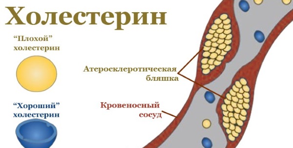 Продукты, снижающие холестерин и очищающие сосуды сердца. Таблица, список