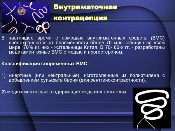 Спираль внутриматочная. Что это такое, виды и цены, как ставят, какая лучше. Список и названия