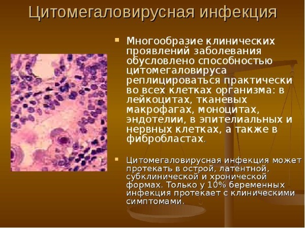 Цитомегаловирус: что это такое. Что значит положительный анализ. Симптомы, лечение. Как передается, проявляется, чем опасен, последствия