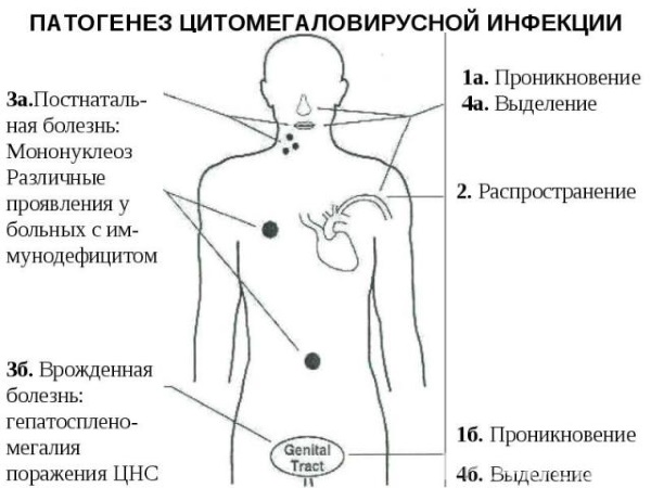 Цитомегаловирус: что это такое. Что значит положительный анализ. Симптомы, лечение. Как передается, проявляется, чем опасен, последствия