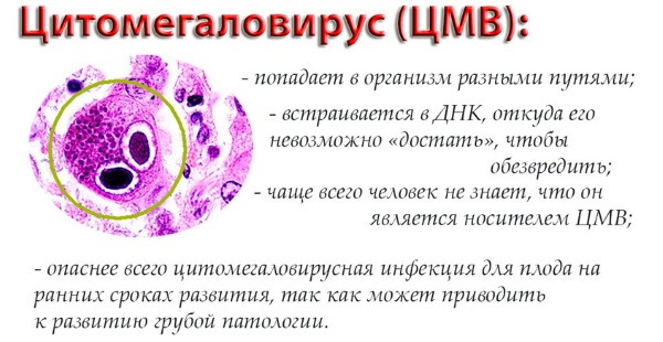 Цитомегаловирус: что это такое. Что значит положительный анализ. Симптомы, лечение. Как передается, проявляется, чем опасен, последствия