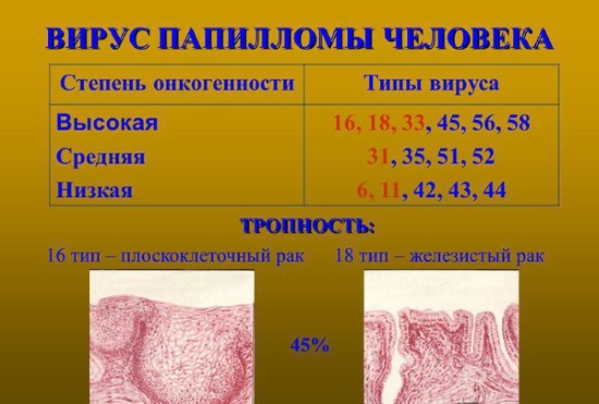 Вирус папилломы человека у женщин в гинекологии. Что это такое, чем опасен, причины, симптомы, как выглядит, передается. Диагностика, анализы, лечение