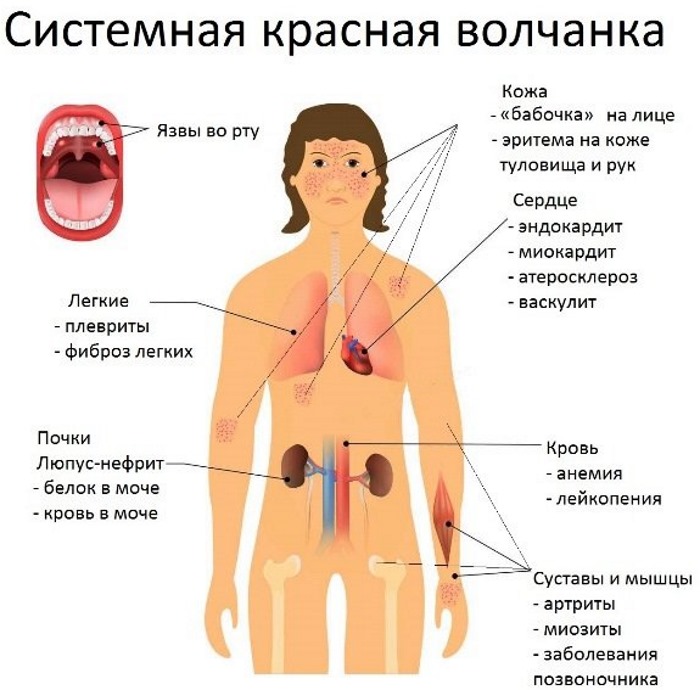 Базофилы повышены в крови у взрослого, ребенка. Причины, о чем это говорит, что делать. Абсолютное содержание, норма