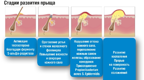 Дегтярное мыло. Польза и вред, состав, свойства, особенности применения в медицине и косметологии