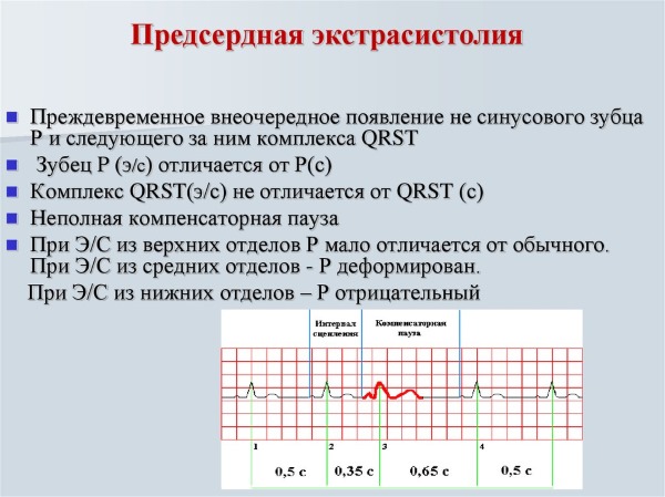 Экстрасистолия карта вызова