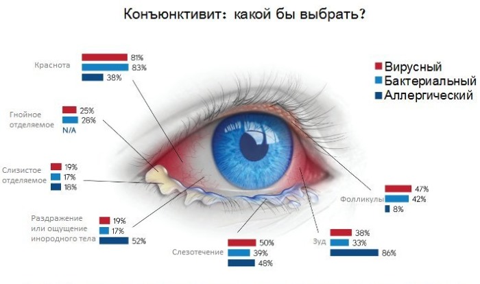 Глазные капли от конъюнктивита вирусного, бактериального, аллергического у детей и взрослых