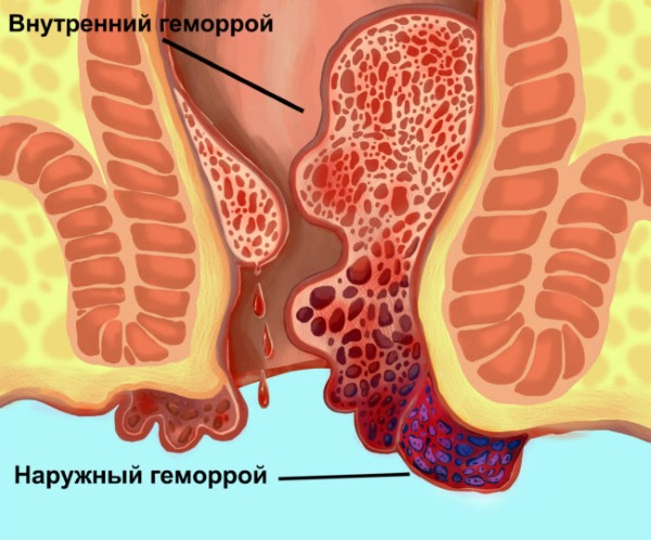 Индометацин. Инструкция по применению препарата в таблетках, свечи, мазь, глазные капли, инъекции. Аналоги