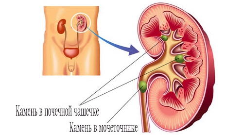 Корень шиповника. Полезные свойства, показания, применение в народной медицине. Рецепт отвара, настоя, чая, спиртовой настойки