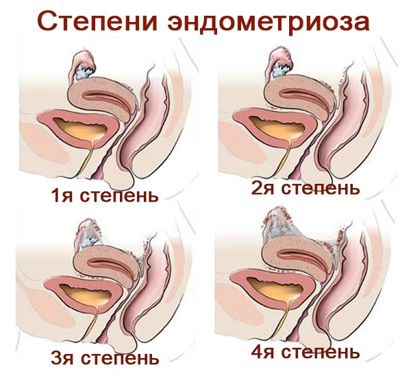 Менструальный цикл: что это, фазы, нарушения, как рассчитать начало, норма, сбой, как восстановить