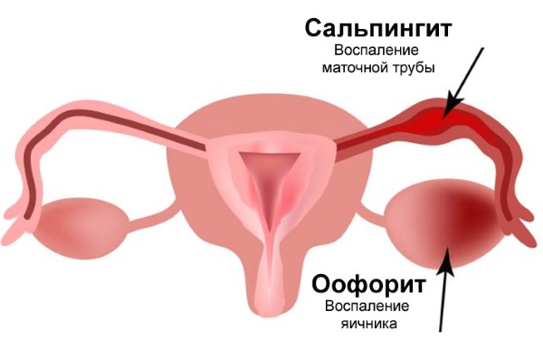 Что такое микоплазма у женщин. Симптомы и лечение народными средствами, препараты. Причины возникновения, как передается, анализ