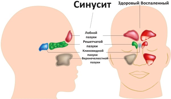 Что такое микоплазма у женщин. Симптомы и лечение народными средствами, препараты. Причины возникновения, как передается, анализ