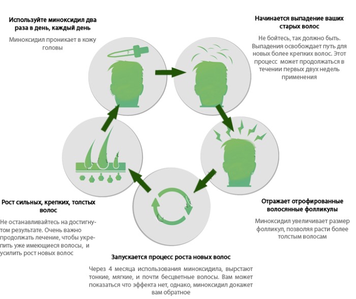 Миноксидил для волос и бороды. Инструкция по применению, аналоги. Цена в аптеке, где купить