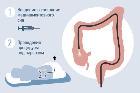 Подготовка к колоноскопии кишечника. Что это такое, как к ней готовиться, бесшлаковая диета, меню, препараты