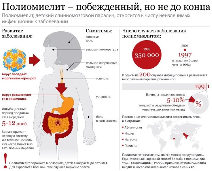 Полиомиелит. Что это, прививка от болезни, график вакцинации, реакция у детей,  симптомы, последствия, осложнения