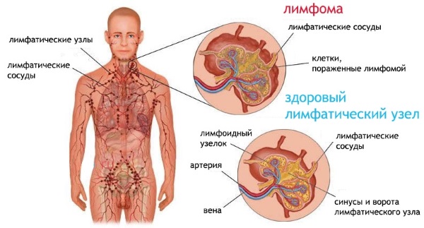 ПЦР диагностика. Что это такое, где применяется, как сдавать, расшифровка анализов