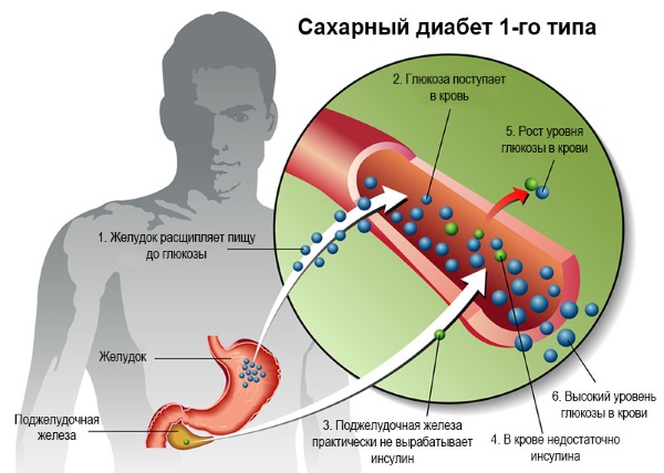 Базофилы повышены в крови у взрослого, ребенка. Причины, о чем это говорит, что делать. Абсолютное содержание, норма