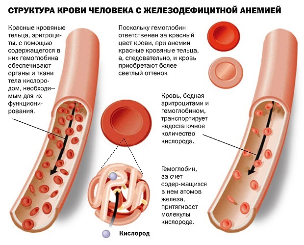 Таблица продуктов, богатые железом. При анемии, беременности, для детей, вегетарианцев, повышения гемоглобина