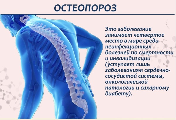 Трава Пол пала. Лечебные свойства, применение в народной медицине от камней в почках и желчном пузыре, других болезней. Противопоказания