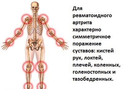 Аркоксия. Состав препарата, показания, инструкция по применению, противопоказания